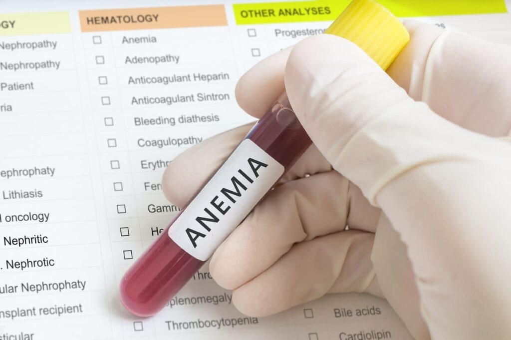 Maharashtra Anaemia Study – Phase 2 (Project Duration – April 2017 to December 2018)